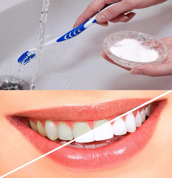 Cách lấy cao răng tại nhà 3