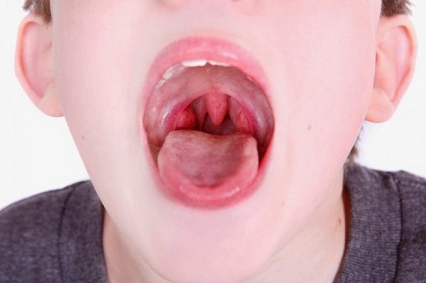 Trẻ ngủ ngáy 2