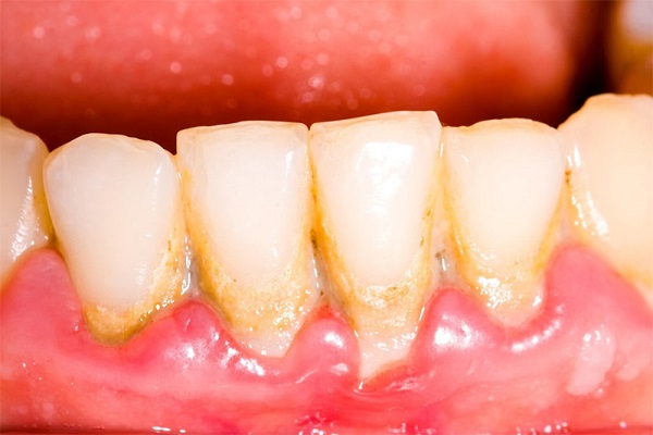 Vệ sinh răng miệng 7