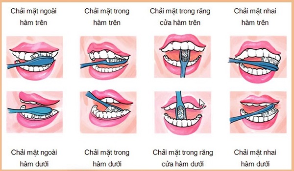 Dấu hiệu mọc răng khôn 8