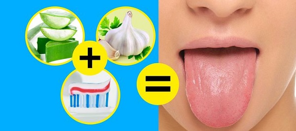 Cách làm sạch lưỡi bị trắng 0