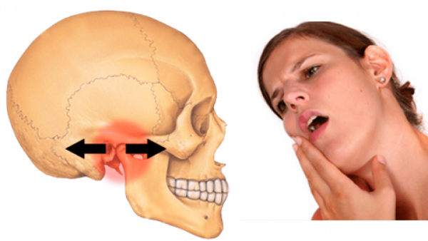 Dấu hiệu răng khôn mọc lệch 5