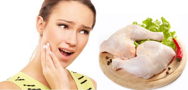 Đau răng kiêng ăn gì 0