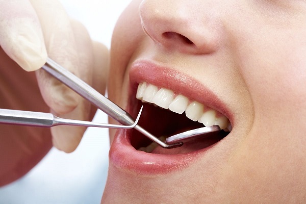 Tẩy trắng răng có hại không 0