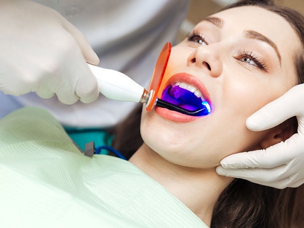 Tẩy trắng răng có hại không 3