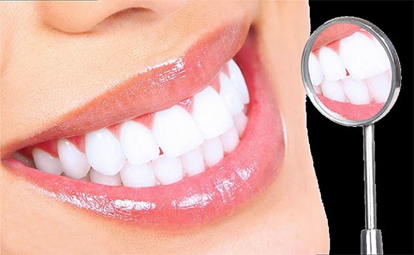 Tẩy trắng răng có hại không 5