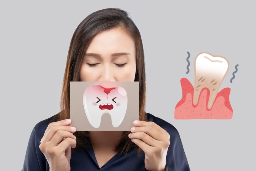 1 hình ảnh bệnh viêm nha chu