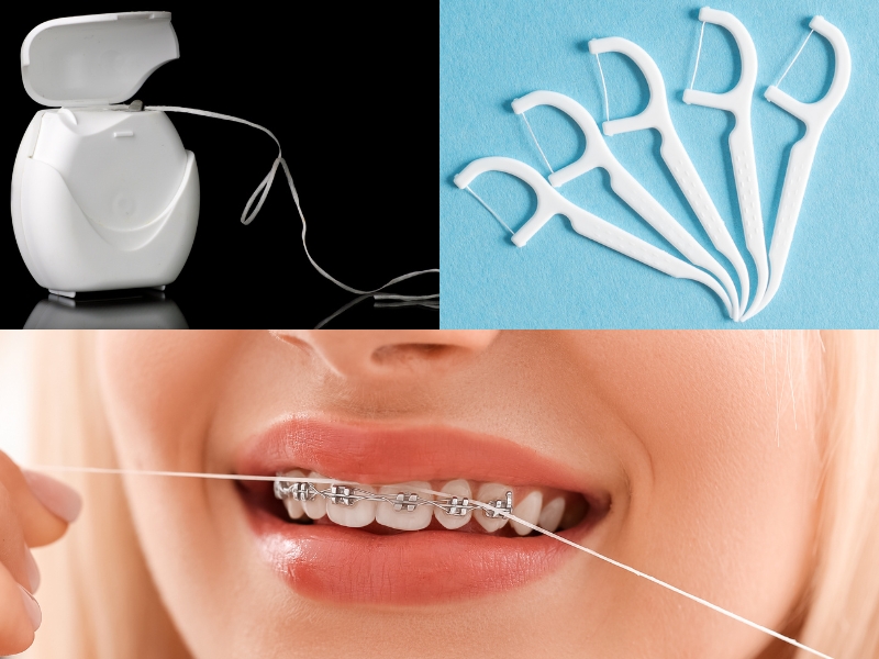 3 các loại chỉ nha khoa thích hợp cho vệ sinh răng miệng