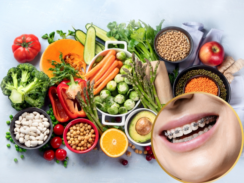8 các loại thực phẩm bạn nên ăn khi niềng răng