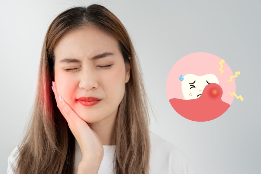 1 viêm nướu răng